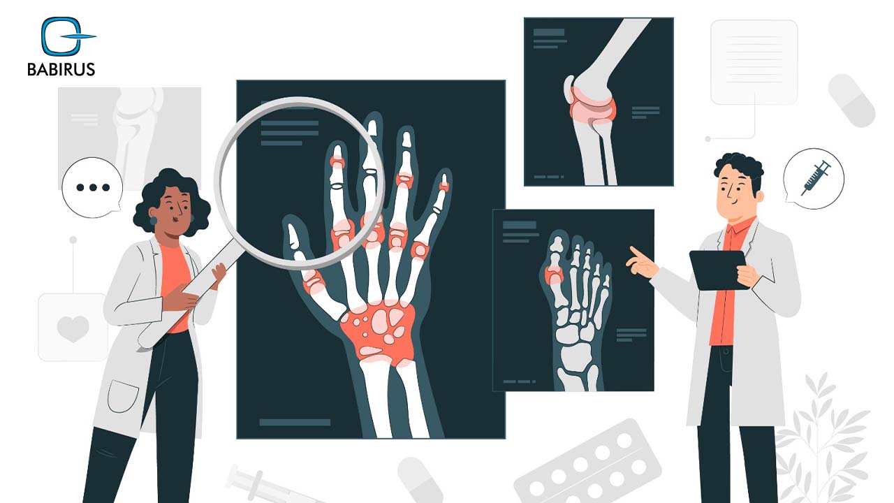 Rheumatology Diagnosis | Babirus