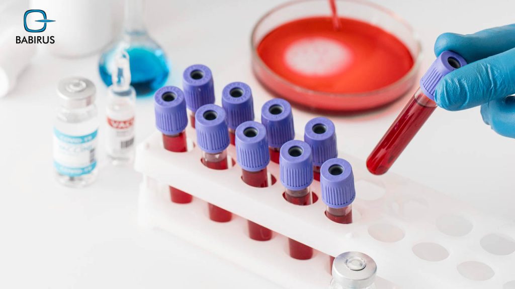 Understanding Your Complete Blood Count (CBC) Tests