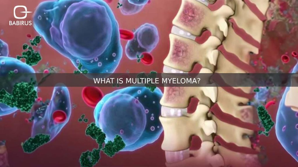 What is Multiple Myeloma? Symptoms, Diagnosis, and Treatment