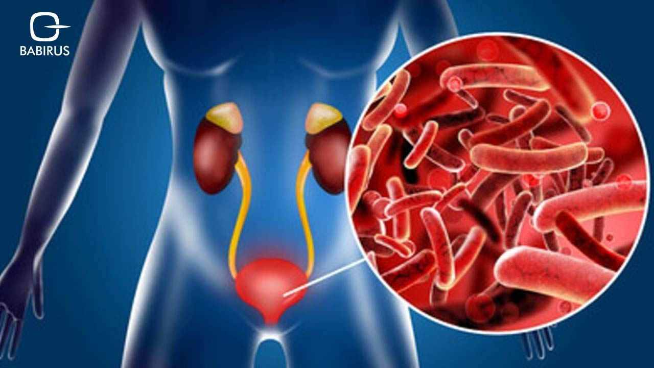 Urinary Tract Infection Diagnosis and Tests | Babirus