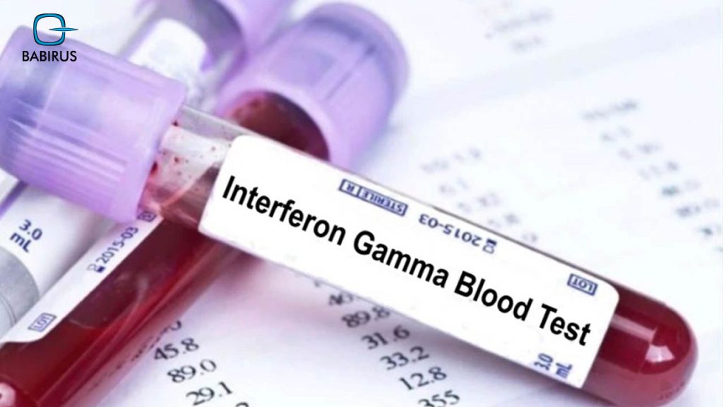 Type of TB (Tuberculosis) Test Results