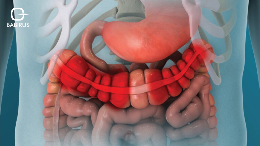 A Guide to Fecal Biomarkers: Key Tests for IBS, IBD, and Gut Inflammation