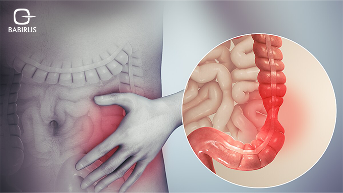 Food intolerance testing using the FoodPrint kit, a diagnostic tool used in the UAE to identify IBS-related food sensitivities.