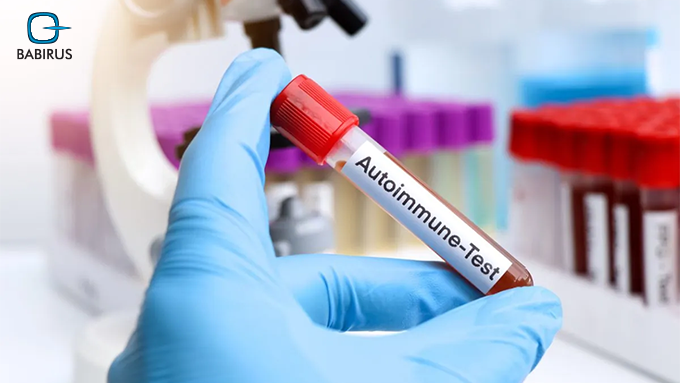 Doctor analyzing autoimmune test results with a patient showing symptoms like joint pain, fatigue, and gut issues, using antibody-based diagnostics.