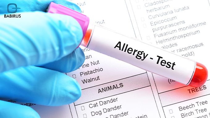 Allergic Endotypes in Biologic Prescribing: The 2026 Guide for UAE Labs 2 MADx molecular allergy testing ALEX3 platform analyzing allergen components for precision biologic treatment decisions